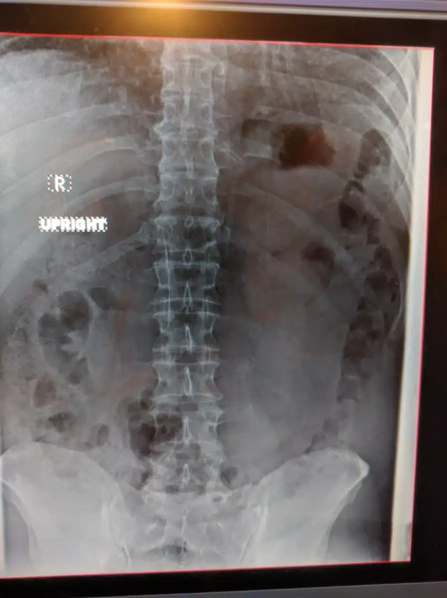 Banner University Medical Center - Thumbnail 4